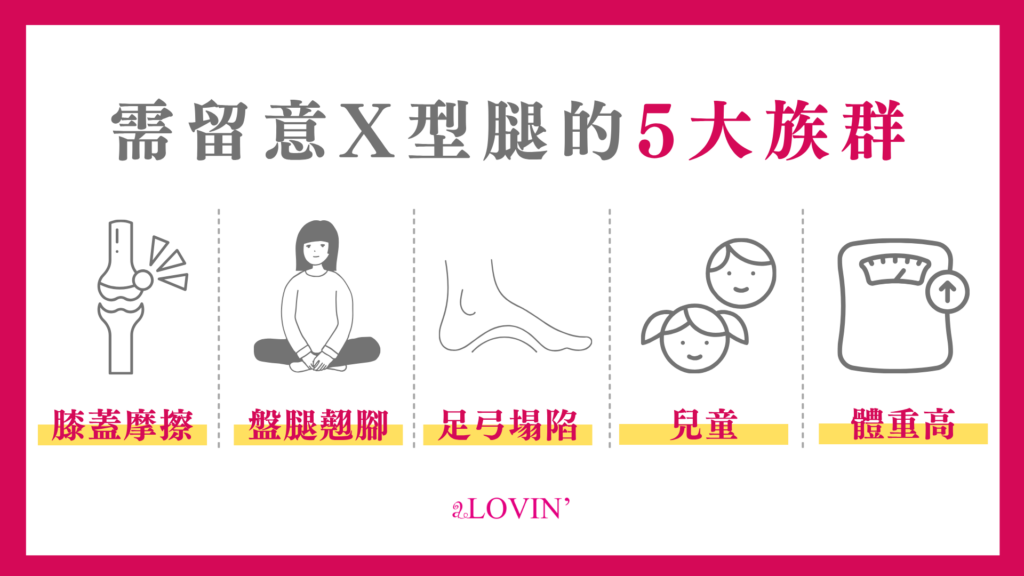 需留意X型腿的5大族群